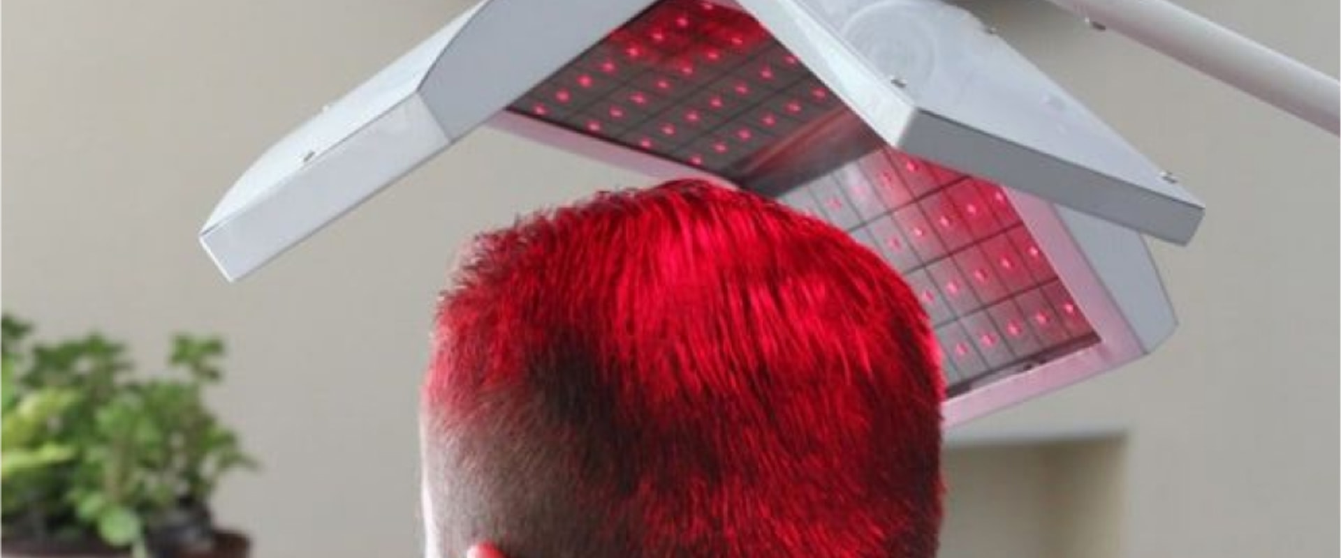 The Truth About Low-Level Laser Therapy for Baldness and Hair Loss