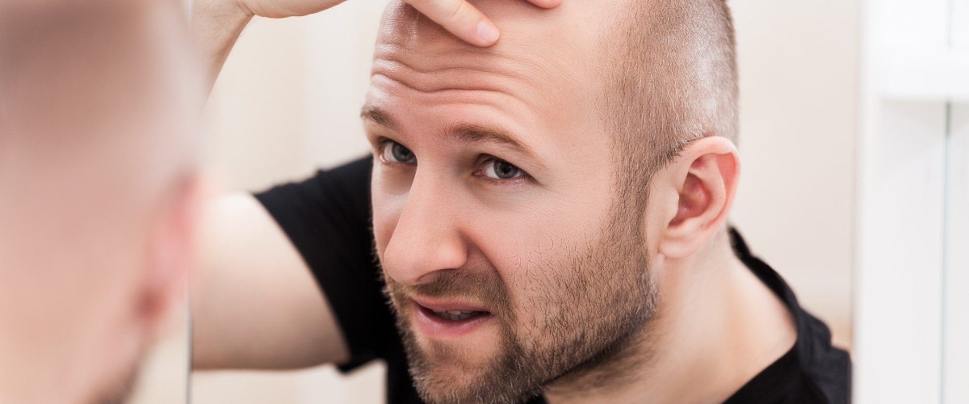 Understanding Genetics and Male Pattern Baldness