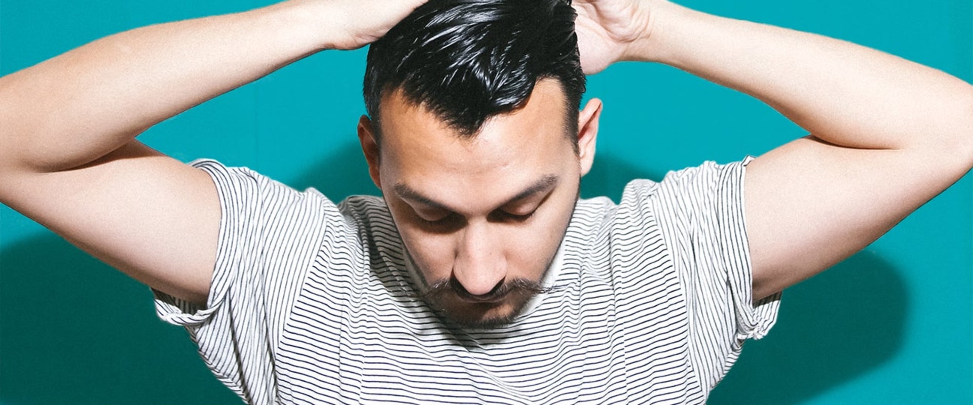 Understanding Medical Treatments for Male Pattern Baldness