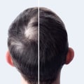 Hair Thickening Sprays: The Solution to Preventing Baldness and Restoring Hair