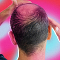 Conditioners for Hair Growth: How to Prevent Baldness and Regrow Your Hair