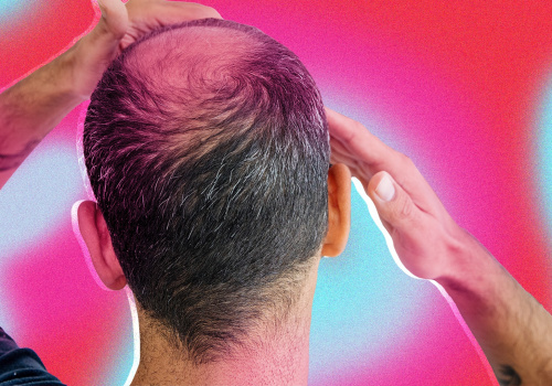 Conditioners for Hair Growth: How to Prevent Baldness and Regrow Your Hair